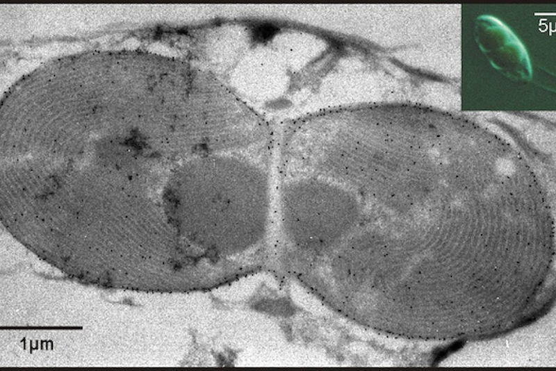 Cyanophora paradoxa (Transmissionselektronenmikroskopie). Zu sehen sind zwei Plastiden (Cyanellen oder Muroplasten) während der Teilungsphase - und r. oben die mit zwei Geißeln versehenen Alge (lichtmikroskopische Aufnahme).